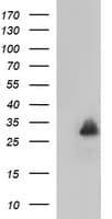MBL2 / Mannose Binding Protein Antibody (clone OTI1A12)