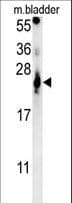 ATP5G2 Antibody (aa85-114)