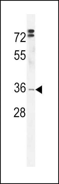 HMCES / C3orf37 Antibody (aa281-310)