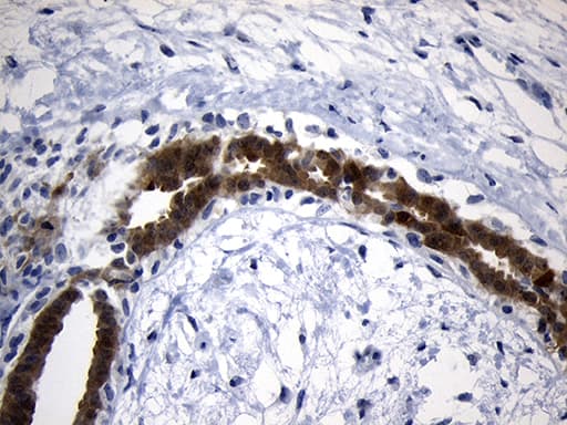 Monoclonal Mouse anti-Human NAT1 / AAC1 Antibody (clone OTI1G1, Carrier-free, IHC, WB)