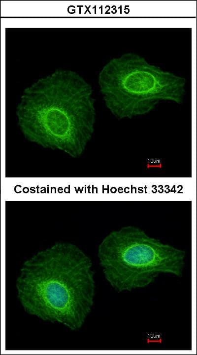 IHC-plus™ Polyclonal Rabbit anti-Human KRT34 / Keratin 34 / KRTHA4 Antibody (aa1-303, IHC, IF, WB)