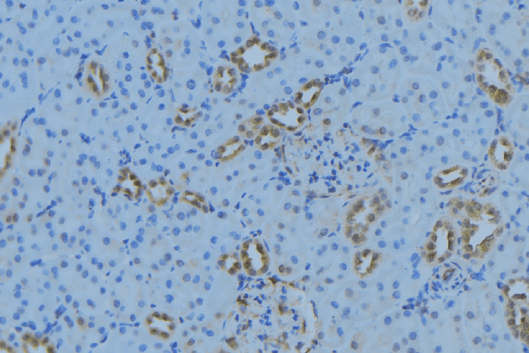 MRPL34 Antibody