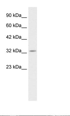 Polyclonal Rabbit anti-Human PAX9 Antibody (HRP, aa67-116, IHC, WB)