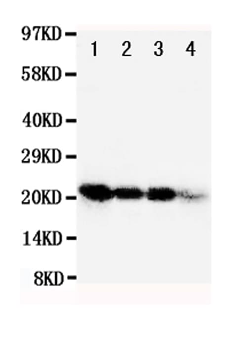 FGF1 / Acidic FGF Antibody (aa16-155)