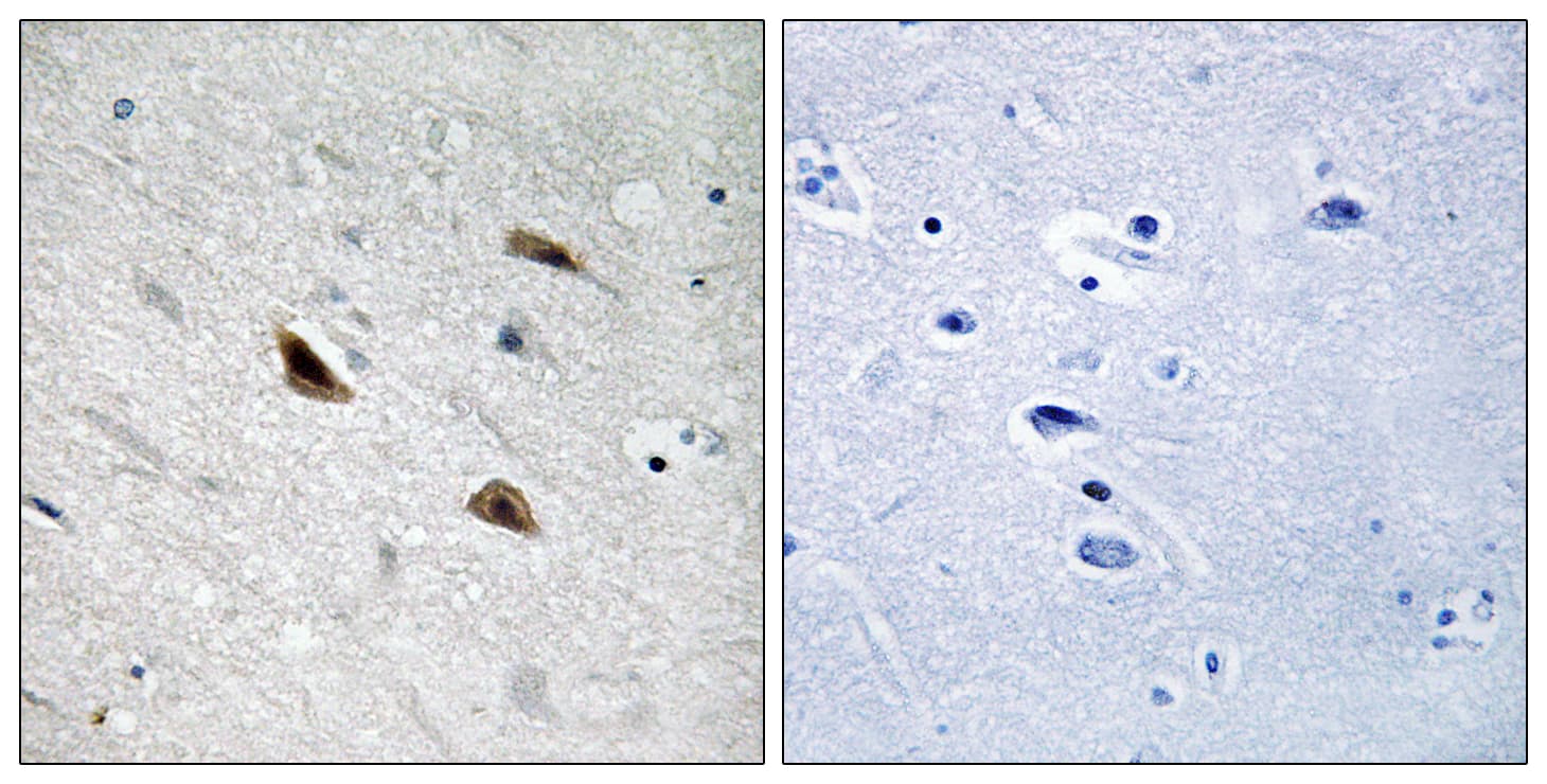 CTNNB1 / Beta Catenin Antibody (phospho-Tyr489)