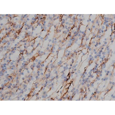 MAPT / Tau Antibody (phospho-Ser356)
