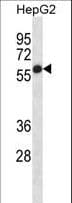 Polyclonal Rabbit anti-Human PLAP / Alkaline Phosphatase Antibody (aa56-83, IHC, WB)