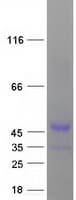 Human CCNY / Cyclin Y Protein (Recombinant Myc-DDK (Flag))