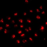 FOXN2 Antibody