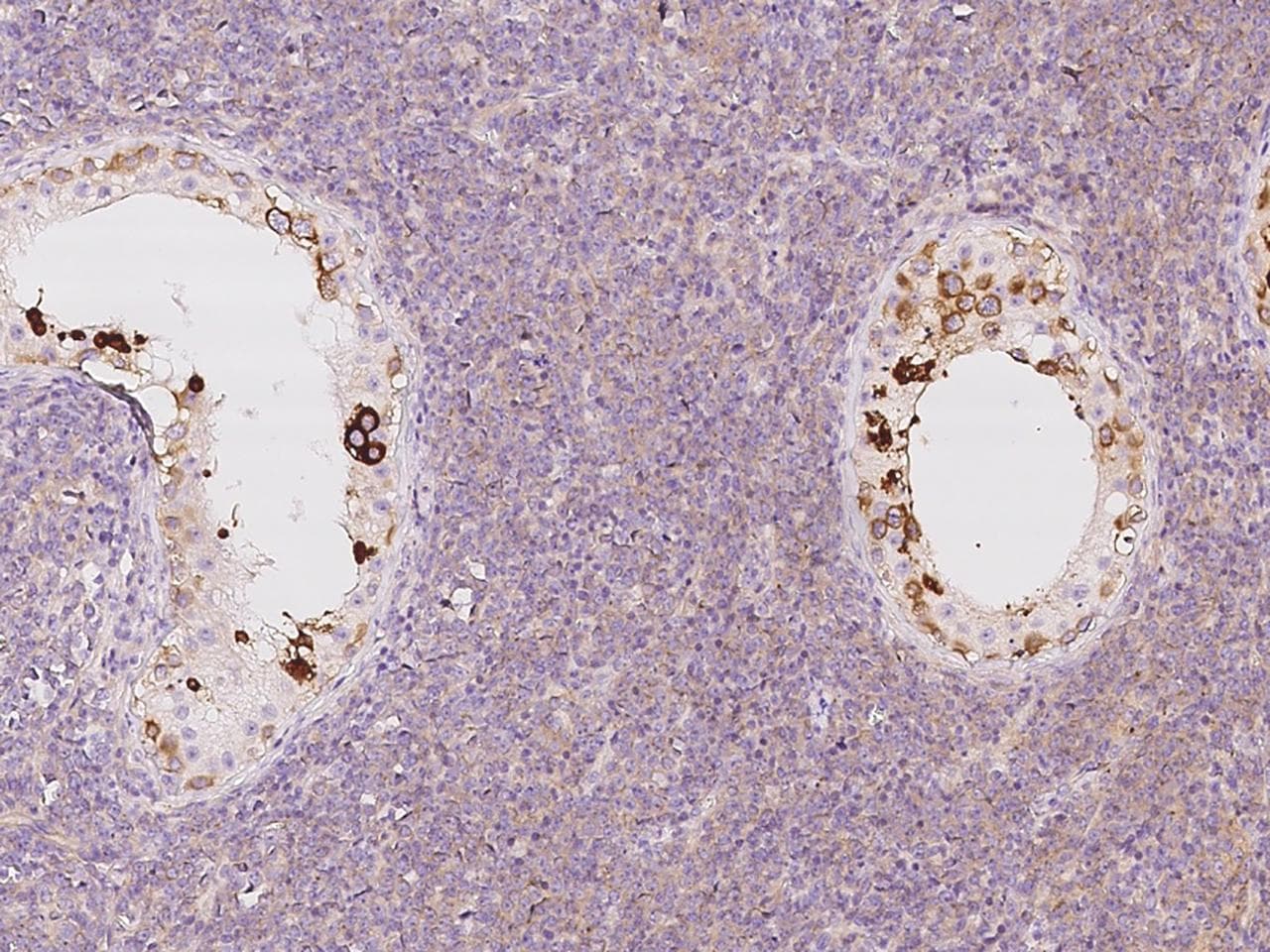 LZTFL1 Antibody