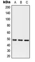 Polyclonal Rabbit anti-Human Alpha-1-Antichymotrypsin Antibody (Internal, WB)