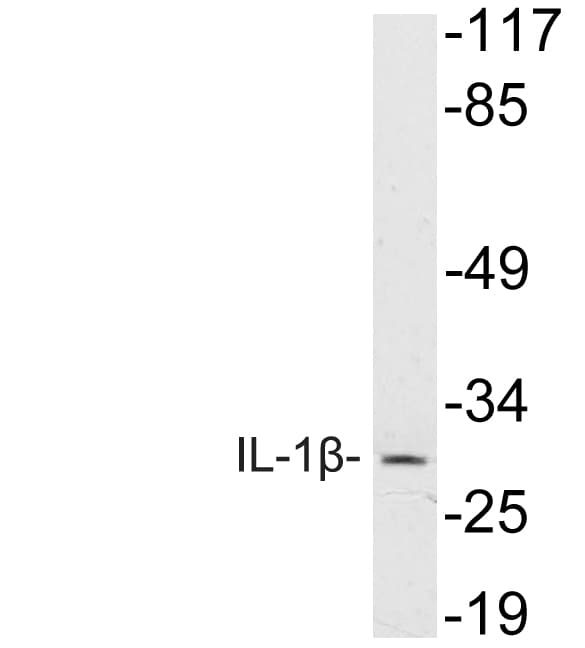 IL-1B / IL-1 Beta Antibody (aa113-162)
