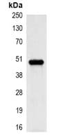 PathPlus™ KRT17 / CK17 / Cytokeratin 17 Antibody