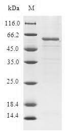 Human HUM2DD / DHDH Protein (Recombinant GST, N-terminus)