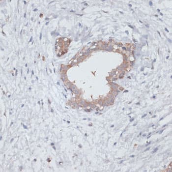TGFBR2 Antibody