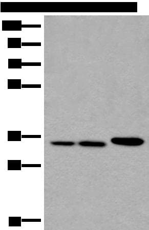 RPF2 / BXDC1 Antibody
