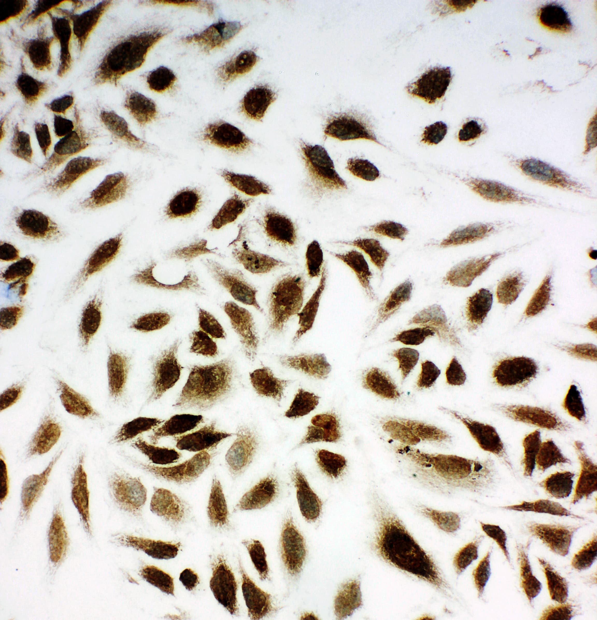 NME1 / NM23 Antibody (aa137-152)