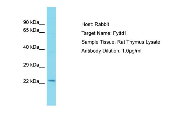 FYTTD1 Antibody (aa101-150)