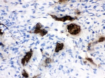 Polyclonal Rabbit anti-Human Osteocalcin Antibody (IHC)