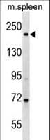 MYH7 Antibody (aa185-211)