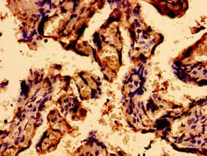 Polyclonal Rabbit anti-Human SACS / Sacsin Antibody (IHC)