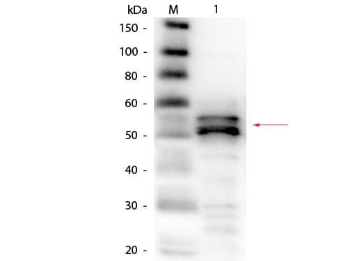 FGA / Fibrinogen Alpha Antibody (Lyophilized, Biotin)