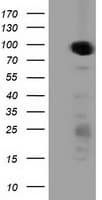 Monoclonal Mouse anti-Human PRKD2 / PKD2 Antibody (clone OTI5A3, IHC, IF, WB)