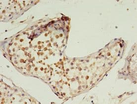 PRTFDC1 / HHGP Antibody (aa2-225, FITC)