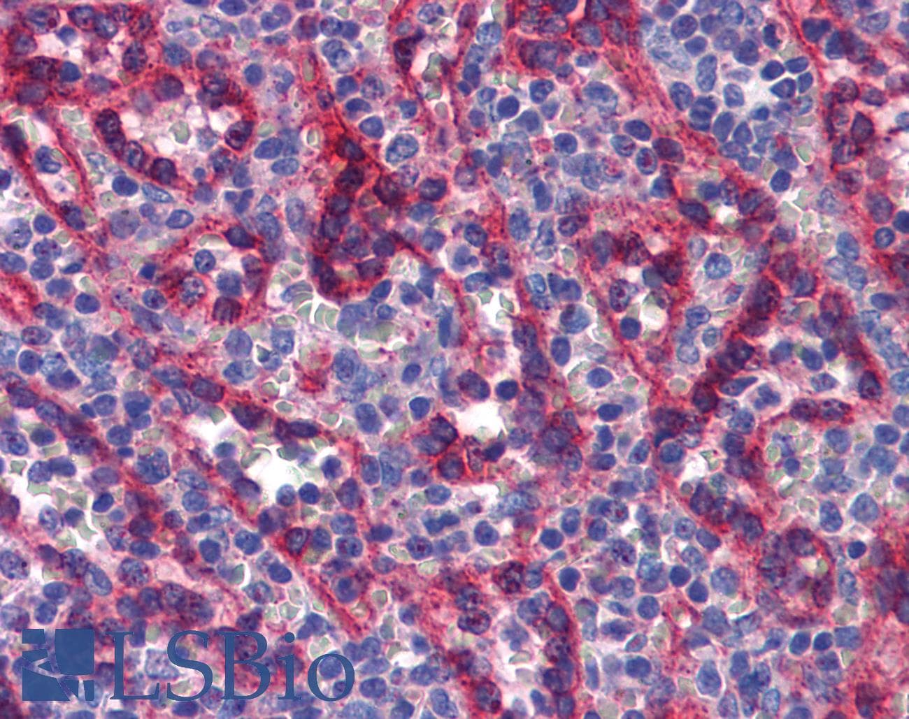 TBX18 Antibody (aa421-470)