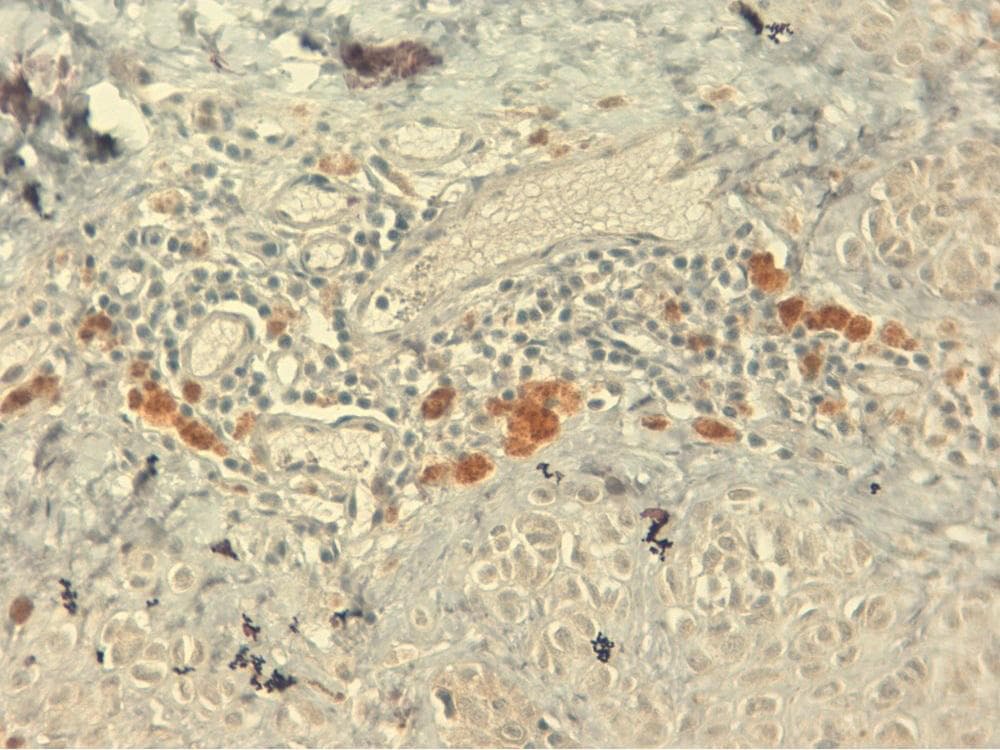 IGF1 Antibody (clone 7973)