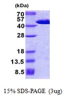 Human FIBP Protein (Recombinant His)