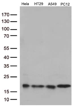 Monoclonal Mouse anti-Human TSEN15 Antibody (clone OTI3F5, Carrier-free, WB)