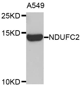 Polyclonal Rabbit anti-Human NDUFC2 Antibody (IHC, IF, WB)