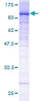 Human RPAP3 / FLJ21908 Protein (Recombinant GST)