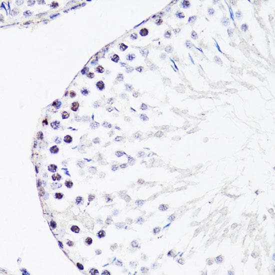 Polyclonal Rabbit anti-Human FGF12 Antibody (IHC)
