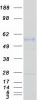 Human PDHX / Protein X / ProX (Recombinant Myc-DDK (Flag))