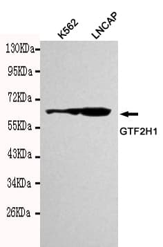 TFB1 / GTF2H1 Antibody (N-Terminus)