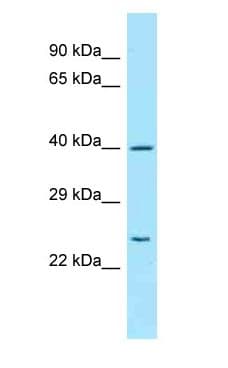 Polyclonal Rabbit anti-Human PEX13 Antibody (C-Terminus, WB)