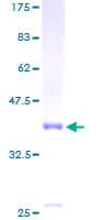 Human NMB / Neuromedin B Protein (Recombinant GST)