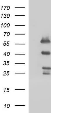 Monoclonal Mouse anti-Human SMAD1 Antibody (clone OTI1C5, IHC, WB)