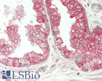 IHC-plus™ ST8SIA2 / STX Antibody