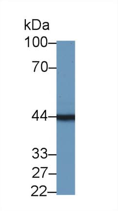 TMOD3 / Tropomodulin 3 Antibody (aa1-352, APC)