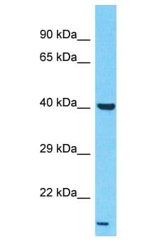LPAR6 / P2RY5 / P2Y5 Antibody (aa85-134)