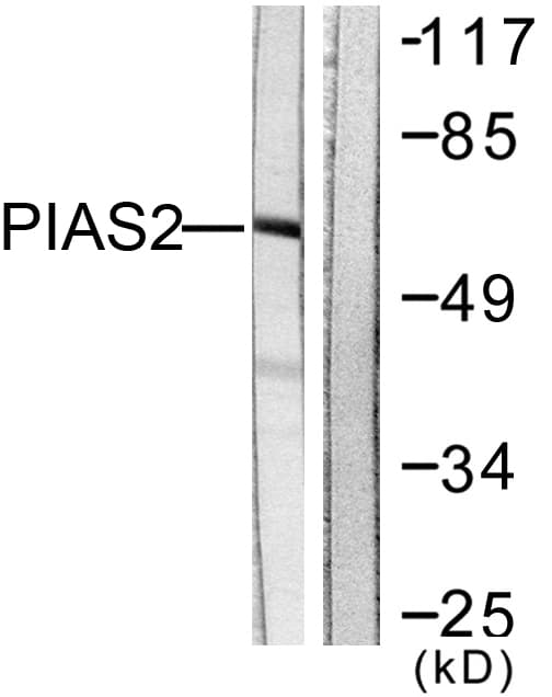 IHC-plus™ PIAS2 / PIASX Antibody (aa10-59)