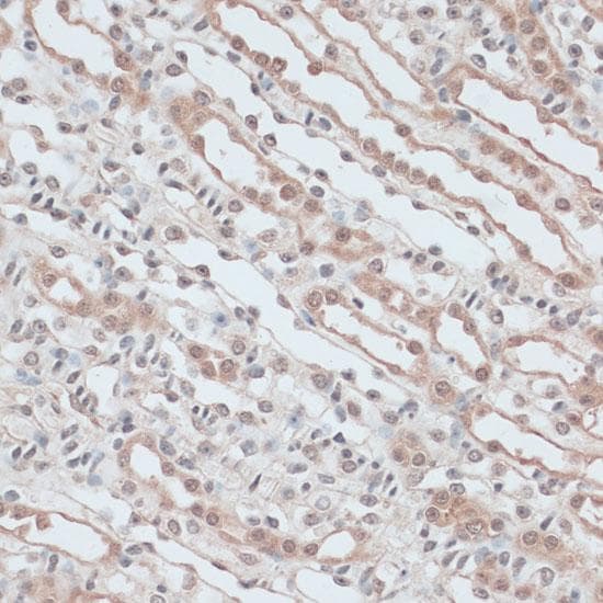 ZNF581 Antibody