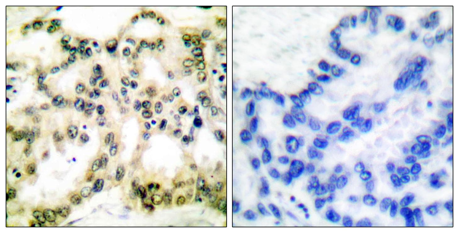 Polyclonal Rabbit anti-Human CCNB1 / Cyclin B1 Antibody (phospho-Ser126, IHC, WB)