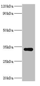 Polyclonal Rabbit anti-Human HYLS1 Antibody (aa70-299, IHC, WB)