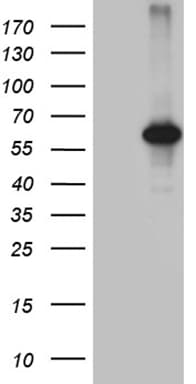 Monoclonal Mouse anti-Human CDY2B Antibody (clone OTI2G1, WB)