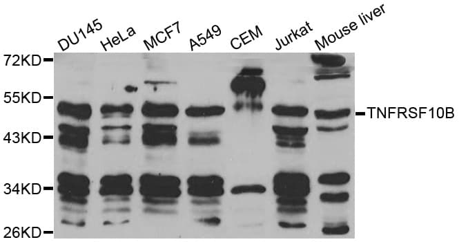 Polyclonal Rabbit anti-Human TNFRSF10B / Killer / DR5 Antibody (IHC, WB)