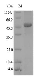 Xanthomonas campestris NAD-dependent deacetylase Protein (Recombinant 6His-SUMO, N-terminus)